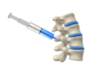 Уколы при остеохондрозе поясницы