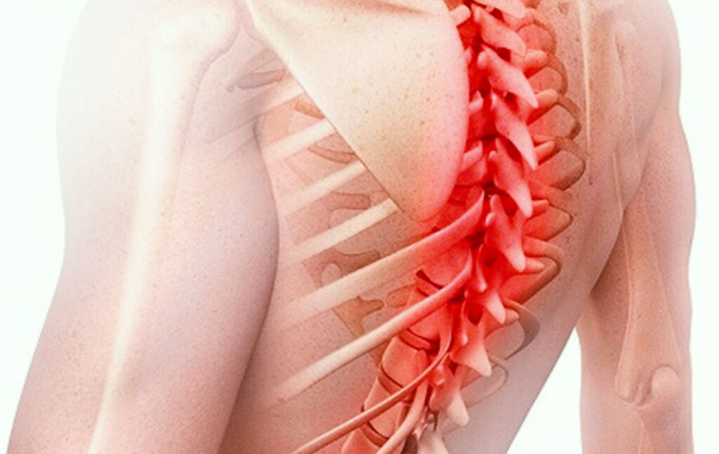 Методы устранения остеохонодроза грудного отдела