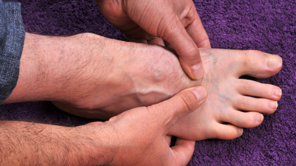 Артроз пальцев ног: как распознать заболевание
