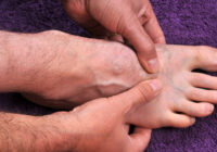 Артроз пальцев ног: как распознать заболевание