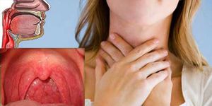 Какие симптомы при ожоге горла