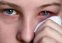 Симптомы и лечение глазного конъюнктивита