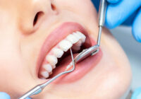 Современная стоматология: почему следует заботиться о здоровье зубов